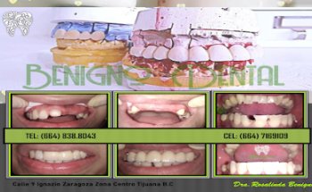 Benigno Dental Clinic