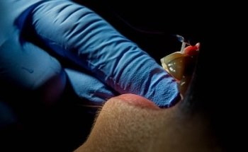 ToothAll Clinica Dental