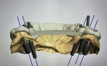 CONSULTORIO DENTAL NaEVa