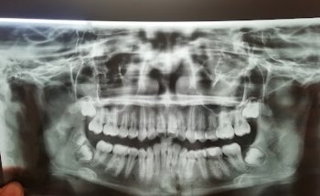 Clínica de odontología y psicología ataygui