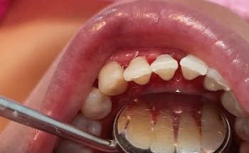 Ainat ODONTOLOGIA INTEGRAL