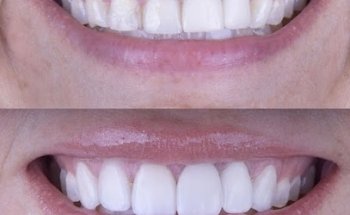 iDent Design Plaza Luxury