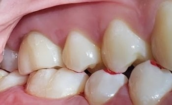 Clinica Dental Advance