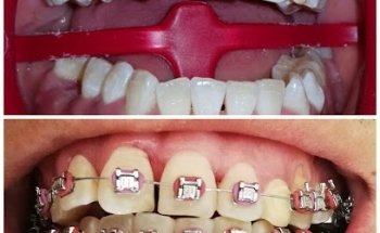 CONSULTORIO DENTAL BIO DENT (Dra. Mancilla)