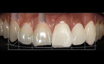 Dr. Manuel I. Paredes L. | Estética Dental y Ortodoncia Estética