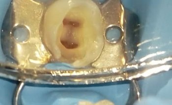 Dr. Mario Escamirosa