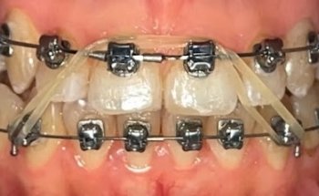 Centro de Rehabilitación Oral. Ortodoncia y Ortopedia Dento-maxilo Facial.