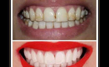 Smile Design California