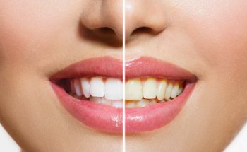 Dr. Edgar Gonzalez Angulo (Dentista)