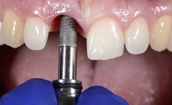 Vivadent Clínica Dental