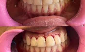 Odontología estética dental Dra. Yedid Vázquez Granados