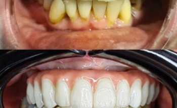 All On 4 Studio Cancun