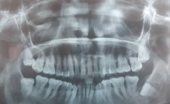 Laser Dental Health /Dra Grisell Centeno