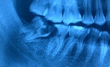 LEDENTO Dental Solutions