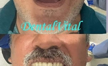 dental vital mex