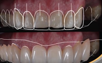 Fast Dental Services