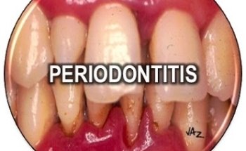 Periodontologia.com.mx