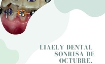 Consultorio dental liaely