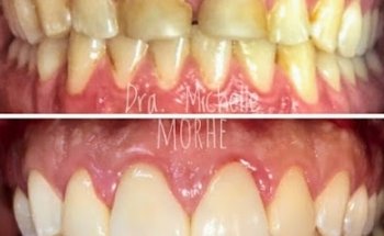 Odontologa | Cirujano Dentista | Dra Michelle Morhe