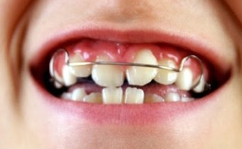 Instituto Maxilofacial Dr. Mateo Arias- Clínica Cirugía Maxilofacial, Dermatología, Medicina Estética, Periodoncia Badajoz