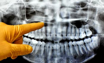 CORD - Centro de Ortodoncia y Rehabilitación Dental