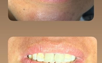 Odontolite Monterrey