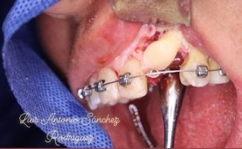 Consultorio Dental SaMaHua Especialidad Ortodoncia y Ortopedia Maxilar