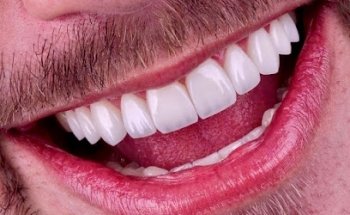 Diseño de Sonrisa CDMX