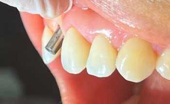 Dentista Cirujano Dental CDMX