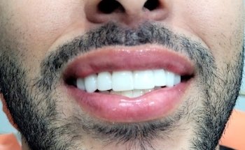 Clínica Dental Ruzafa