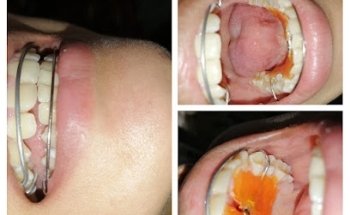 Consultorio Dental Genesis