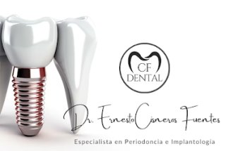 Dr. Ernesto Cisneros Fuentes - Dentista Especialista Periodoncia e implantes dentales