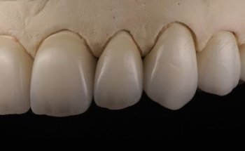 Vida Dental Mazatlán