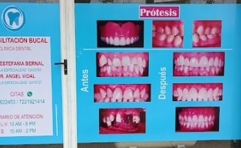 Rehabilitacion Bucal. Consultorio dental