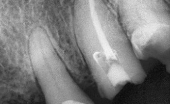 C.E.O Dental (Centro de especialidades odontológicas)