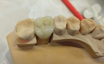 GROWDENT (Odontología Estética y Armonización Orofacial.)