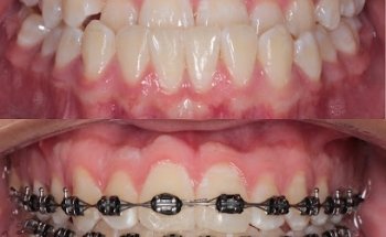 Centro de Especialistas en Ortodoncia