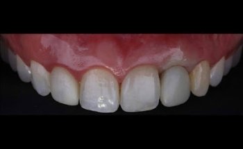 Dental Care Center Leon