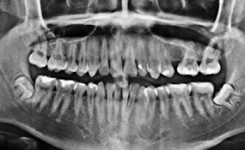 Dental Clean-Inc Tonalá