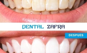 Dental Zafra