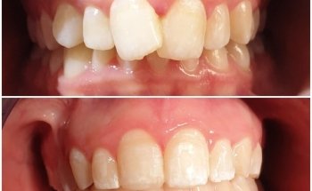 Dental Clinic - Dentist - Ortodoncia Albatera