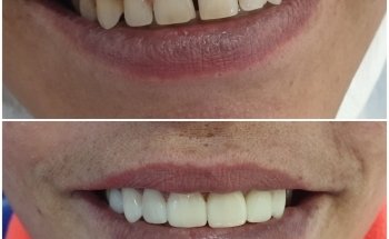 Dental Clinic - Dentist - Ortodoncia Albatera