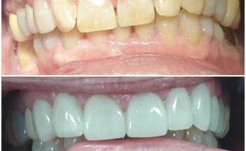 Dental Clinic - Dentist - Ortodoncia Albatera