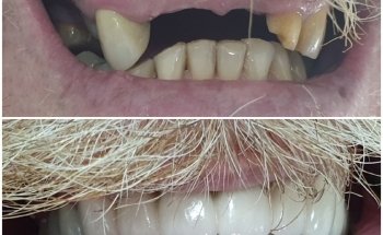 Dental Clinic - Dentist - Ortodoncia Albatera