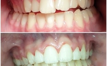 Dental Clinic - Dentist - Ortodoncia Albatera