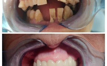 Dental Clinic - Dentist - Ortodoncia Albatera