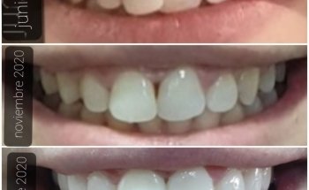 Dental Clinic - Dentist - Ortodoncia Albatera