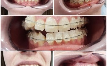 Dental Clinic - Dentist - Ortodoncia Albatera