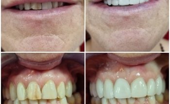 Dental Clinic - Dentist - Ortodoncia Albatera