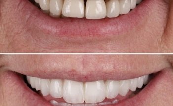 Clean Teeth Dental